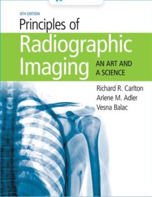 Solution Manual for Principles of Radiographic Imaging 6th Edition Carlton